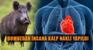 Domuzdan insana ilk kalp nakli yapıldı.
