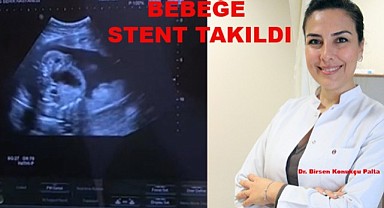 Anne Karnındaki Bebeğe Stent Takıldı