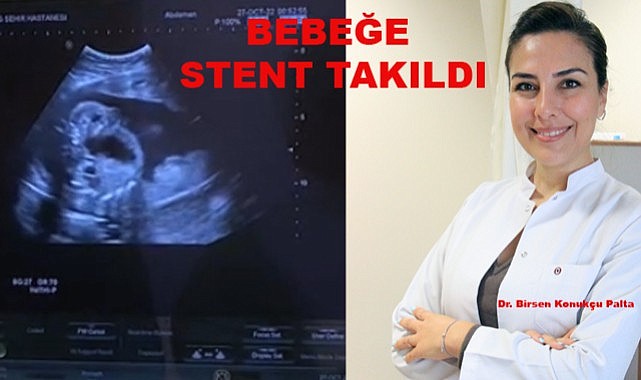 Anne Karnındaki Bebeğe Stent Takıldı